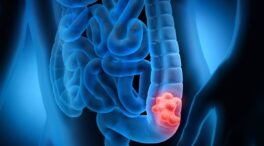 Logran prevenir el dolor neuropático asociado a la quimioterapia del cáncer de colon