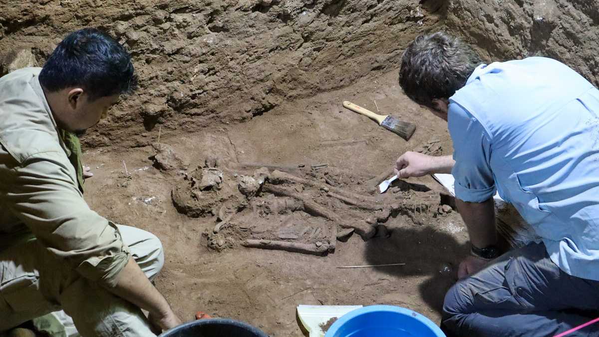 Unos restos óseos en Borneo apuntan que la primera amputación quirúrgica de la historia se habría realizado hace 31.000 años a un niño