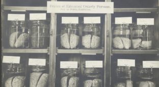 ¿Cómo funciona el cerebro cuando se disecciona desde las humanidades?