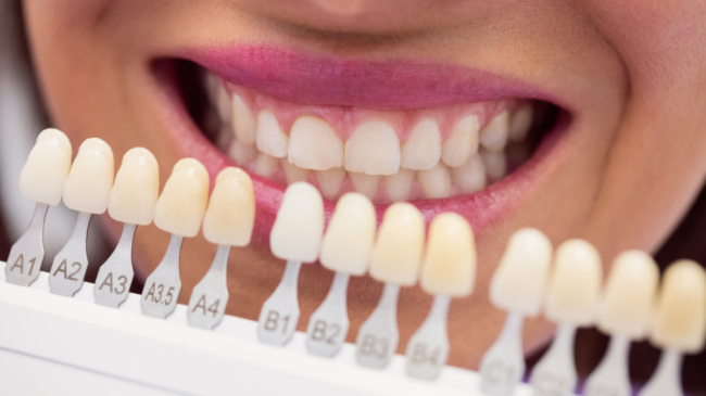 Los cuatro peores errores más comunes después de un blanqueamiento dental