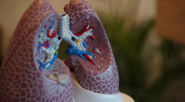 Un fármaco podría ayudar a luchar contra un tipo de cáncer de pulmón que afecta a jóvenes