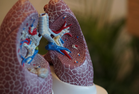 Un fármaco podría ayudar a luchar contra un tipo de cáncer de pulmón que afecta a jóvenes