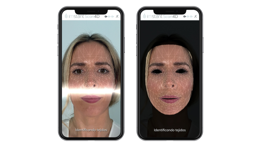 Diagnóstico facial a través del móvil. (Fuente: iMstant)