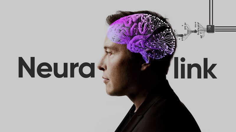 Musk asegura que podrá realizar implantes cerebrales en seres humanos en seis meses