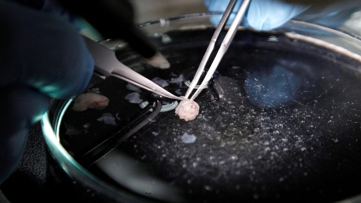 Logran madurar neuronas humanas a partir de células madre que servirán para estudiar enfermedades neurodegenerativas