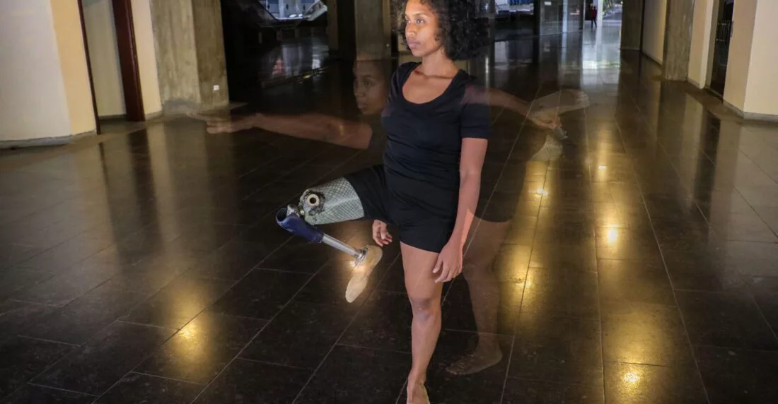 Yraidy Blanco, la bailarina de una sola pierna que se levanta con ayuda de sus amigos