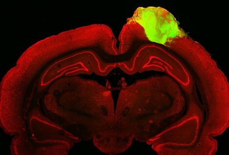 Organoides cerebrales humanos responden a estímulos visuales al trasplantarlos en ratas