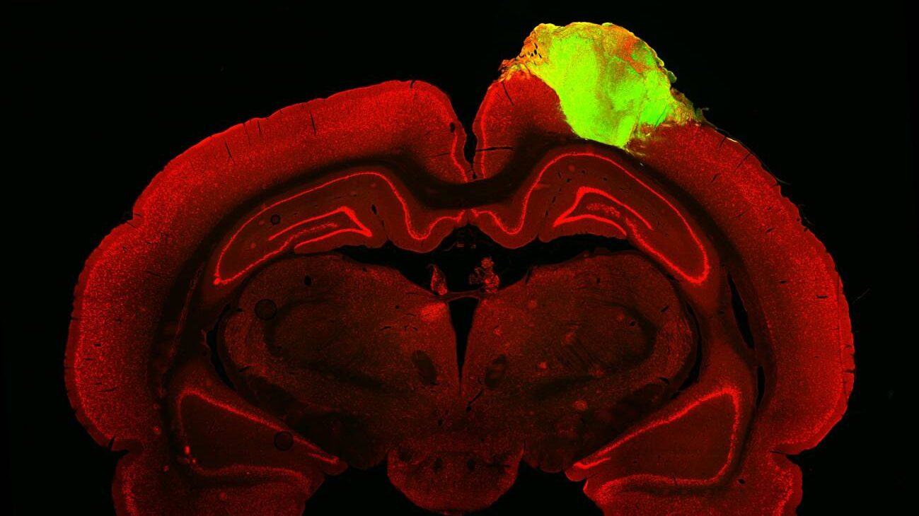 Organoides cerebrales humanos responden a estímulos visuales al trasplantarlos en ratas