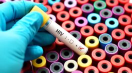 Tercer caso en el mundo de curación del VIH después de un trasplante de células madre