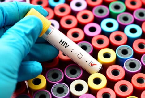 Tercer caso en el mundo de curación del VIH después de un trasplante de células madre