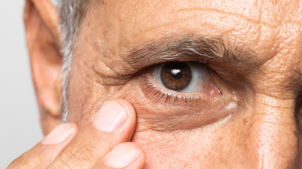 Un hombre maduro comprueba la salud ocular de sus ojos