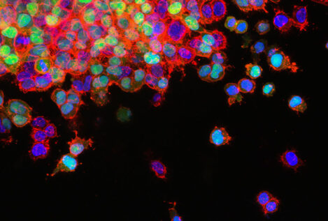 El 'suicidio' de las células cancerosas: nuevos hallazgos podrían mejorar los tratamientos