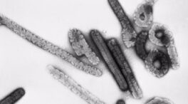 ¿Qué es el virus Marburgo?: origen, síntomas, formas de transmisión y tratamiento