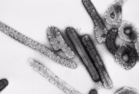 ¿Qué es el virus Marburgo?: origen, síntomas, formas de transmisión y tratamiento