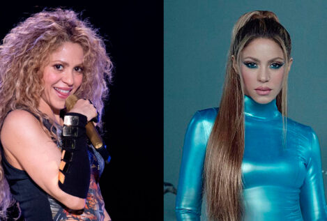 El nuevo retoque de Shakira (y todas las veces que ha abrazado a la cirugía estética)