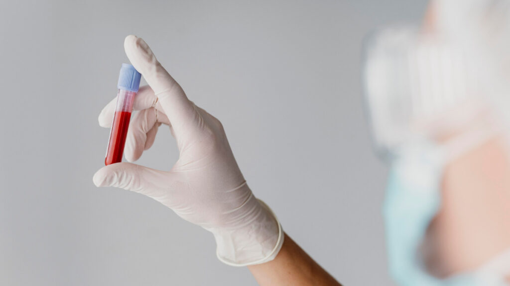 Un médico con una muestra de sangre en un tubo de ensayo