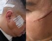 Brutal agresión en Badalona: acuchillan la cara de un vecino tras intentar robarle