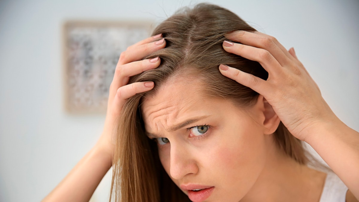 Alopecia femenina: un problema médico más allá de la caída del cabello