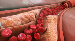Una proteína más útil que el colesterol para predecir el riesgo de infarto