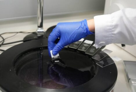 La córnea artificial desarrollada en Granada finaliza con éxito su primer ensayo en pacientes