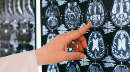 El mito neurológico: el cerebro no es como pensabas