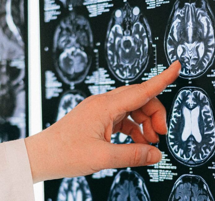 El mito neurológico: el cerebro no es como pensabas