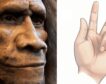 La ‘enfermedad del vikingo’ puede deberse a genes heredados de los neandertales