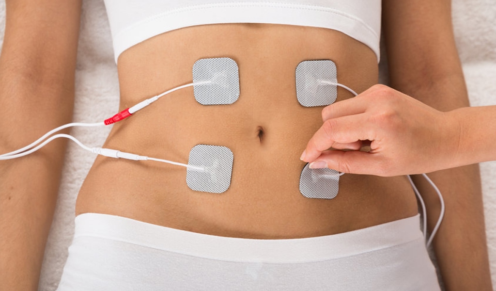 Electroestimuladores colocados en la zona del abdomen. (Fuente: Mimas)