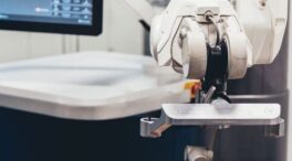 Españoles crean el primer robot quirúrgico del mundo con 'tracking' para operar la columna