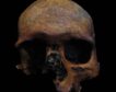 Detectado un caso de tumor craneal de época romana en la península ibérica