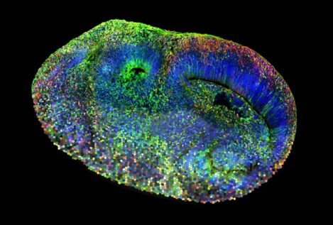 Organoides cerebrales para desvelar los enigmas genéticos del autismo