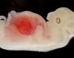 Crean riñones ‘humanizados’ en embriones de cerdo durante 28 días