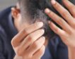 Caída del pelo en otoño: cuánto dura y qué comer para evitarlo lo máximo posible