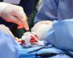 Logran el primer transplante a un hombre vivo de un riñón de cerdo modificado genéticamente