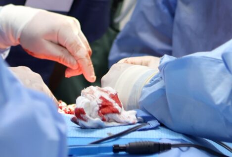 Logran el primer transplante a un hombre vivo de un riñón de cerdo modificado genéticamente