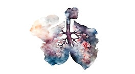 Los pacientes de cáncer de pulmón son cada vez más jóvenes y hay más mujeres
