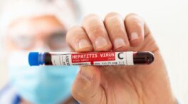 Por qué aún no hay vacuna contra la hepatitis C y es tan importante desarrollarla