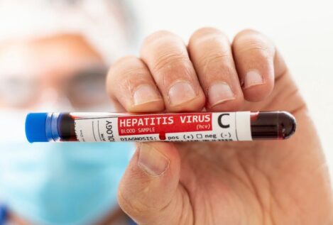 Por qué aún no hay vacuna contra la hepatitis C y es tan importante desarrollarla