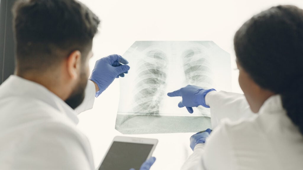 Dos médicos ven una radiografía de los pulmones
