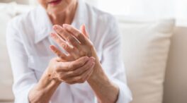 Por qué las mujeres tienen más riesgo de padecer lupus, artritis o esclerosis múltiple