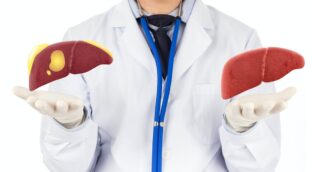 Entre dos y tres adultos de cada diez sufren hígado graso: ¿cómo podemos prevenirlo?