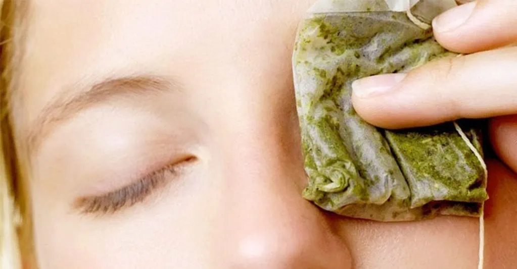 Cuatro remedios caseros contra las ojeras