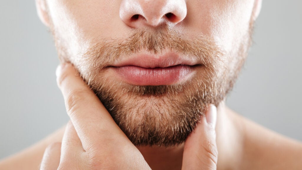 Las cirugías de marcación de mandíbula son de las más demandadas por los hombres. (Fuente: Face Clinic)