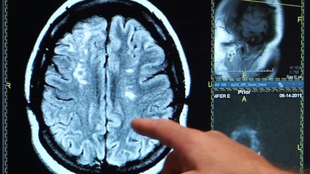 Una nueva técnica permite una visión sin precedentes del cerebro en tiempo récord