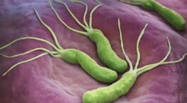 Helicobacter pylori: qué es, cómo averiguar que lo tienes y cómo tratarlo, según Mayo Clinic