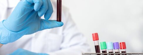 Sale a la luz el nuevo grupo sanguíneo después de más de 50 años de investigación