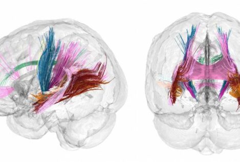 Primer mapa completo de la ‘metamorfosis’ cerebral del embarazo