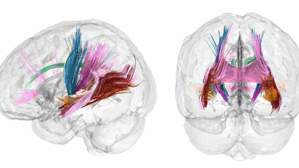 Primer mapa completo de la ‘metamorfosis’ cerebral del embarazo