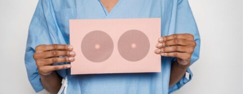 Un estudio revela el impacto de la comida saludable en el cáncer de mama