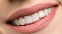 Las cinco alternativas naturales para que tus dientes dejen de estar amarillos